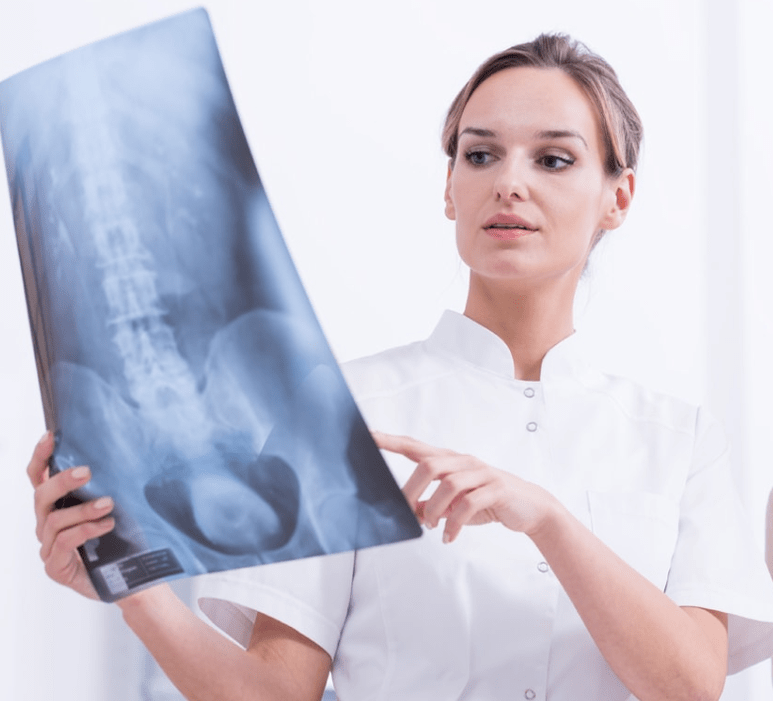 Діагностика грудного остеохондрозу по рентгенологічного дослідження