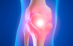 причини розвитку артрозу колінного суглоба