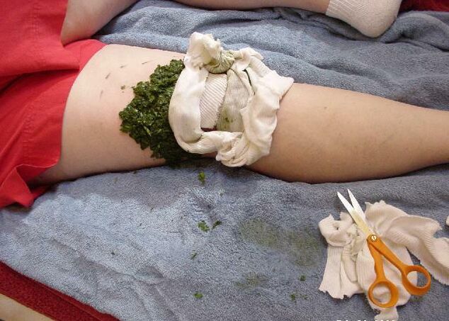Теплий компрес із подрібненого капустяного листя на хворий колінний суглоб при артрозі